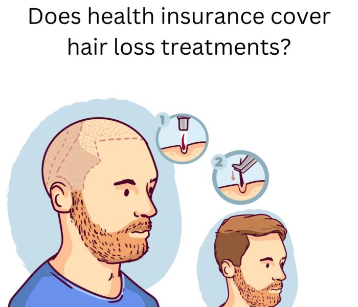 health insurance cover hair loss treatments