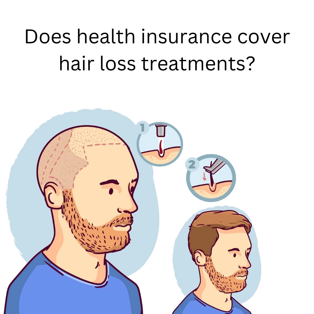 health insurance cover hair loss treatments